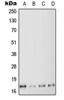 MYL6 Antibody (Internal)