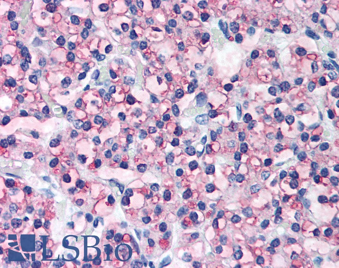 IHC-plus™ PTH / Parathyroid Hormone Antibody (aa71-115)