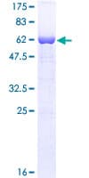 Human FMR1 / FMRP Protein (Recombinant GST)