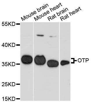 Polyclonal Rabbit anti-Human OTP Antibody (WB)