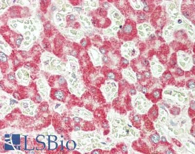 IHC-plus™ PHB / Prohibitin Antibody (clone 5H7)