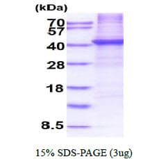 Human CD5 Protein (Recombinant His)