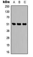 Polyclonal Rabbit anti-Human IDH2 Antibody (Internal, WB)