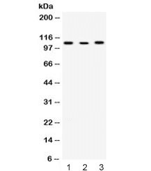 ACTN4 Antibody
