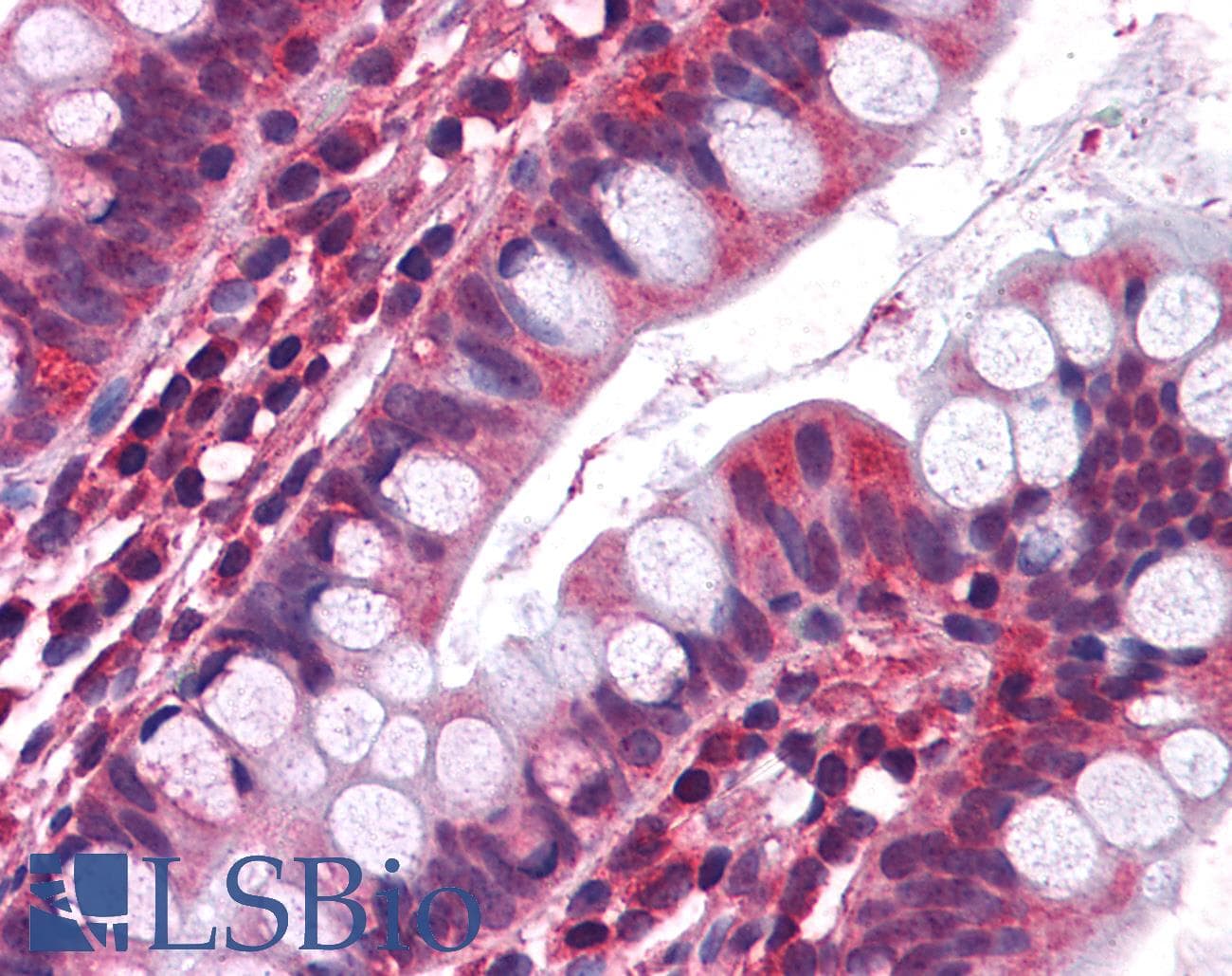 IHC-plus™ HTR3A / 5-HT3A Receptor Antibody (aa428-439)