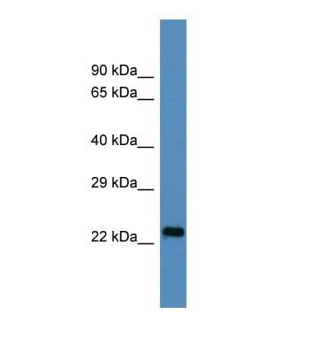 U2AF1L4 Antibody (aa23-72)