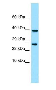 PRLTS / PDGFRL Antibody (aa44-93)