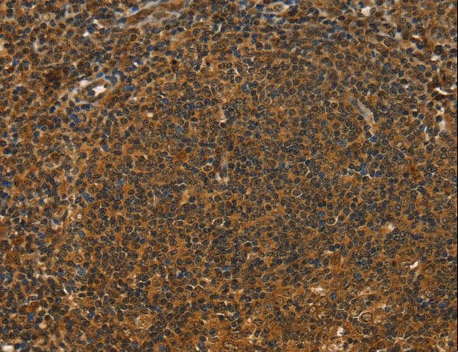 STAR Antibody
