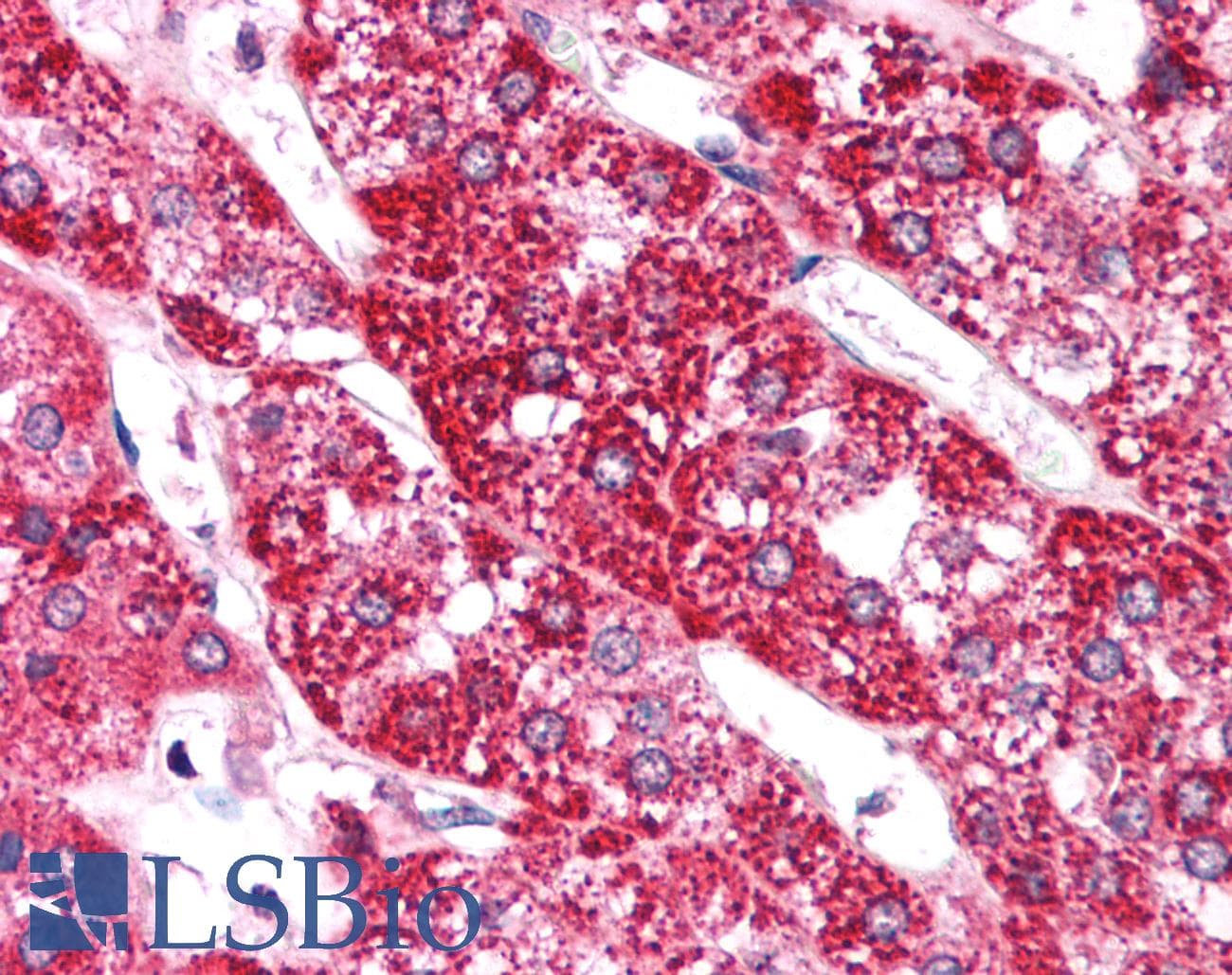 DAP-5 / EIF4G2 Antibody (aa766-815)