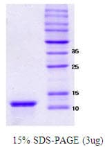 Human SNCA / Alpha-Synuclein Protein (Recombinant)