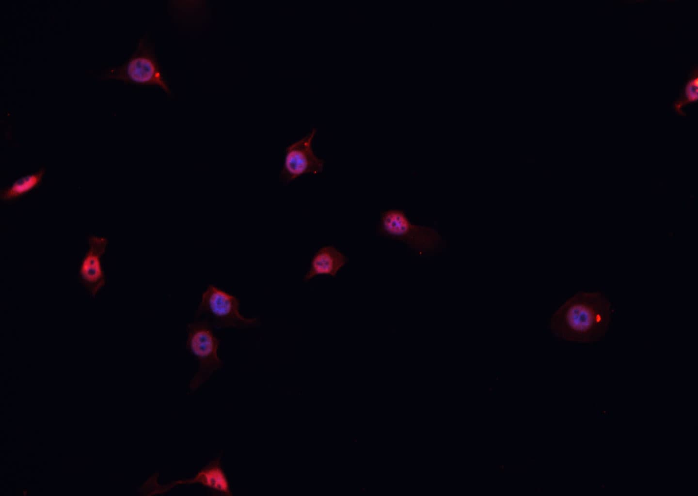 CCND1 / Cyclin D1 Antibody