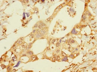 Polyclonal Rabbit anti-Human FAM187B Antibody