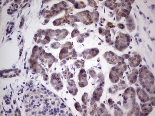 PKD3 / PRKD3 Antibody (aa300-508, clone OTI3D8)