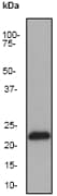 CRADD / RAIDD Antibody (C-Terminus, clone EPR1640Y)