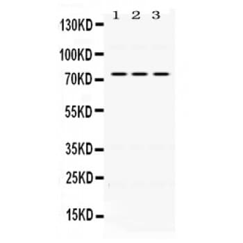 IL2RB / CD122 Antibody (aa503-539)