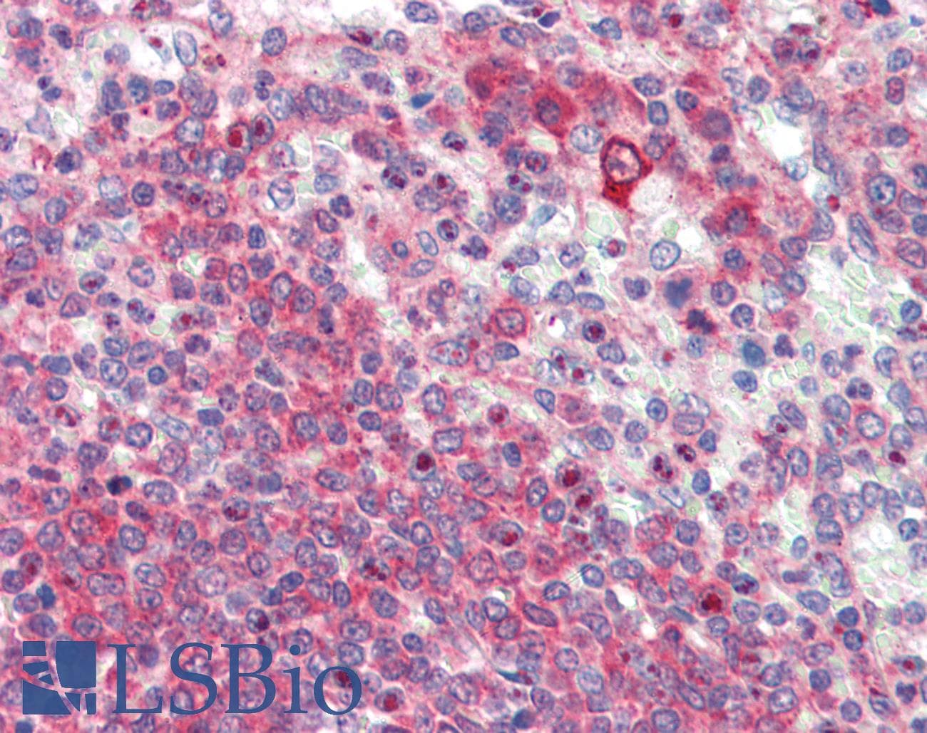 IHC-plus™ Latexin / MUM Antibody (aa78-107)