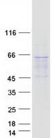 Human RETSAT Protein (Recombinant Myc-DDK (Flag))