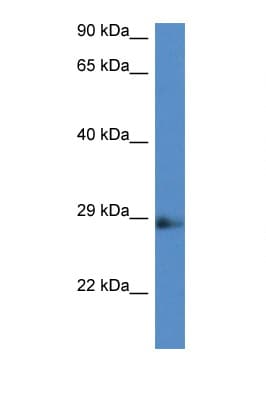 NAA11 / ARD1B Antibody (aa103-152)