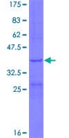 Human MRPL34 Protein (Recombinant GST)
