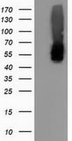 Monoclonal Mouse anti-Human CALCOCO2 Antibody (clone OTI2D11, IF, WB)