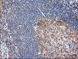 MAPRE2 / EB2 Antibody (clone OTI7A2)