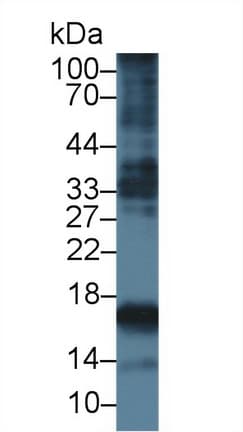 Procollagen III N-Terminal Propeptide Antibody (FITC)