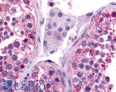 PathPlus™ Polyclonal Rabbit anti-Human CDC7 Antibody (Kinase Domain, IHC)