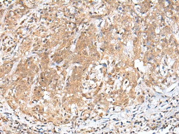 Polyclonal Rabbit anti-Human PEG3 Antibody (IHC)