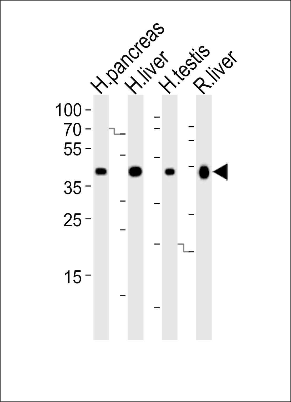 IHC-plus™ Polyclonal Rabbit anti-Human HMGCS2 / HMG-CoA Synthase 2 Antibody (aa478-508, IHC, WB)
