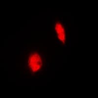 Polyclonal Rabbit anti-Human ERG Antibody (IHC, IF, WB)