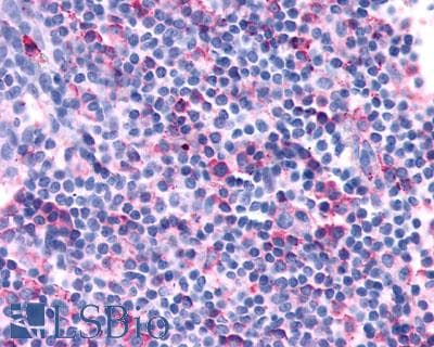 PathPlus™ Polyclonal Rabbit anti-Human CXCR3 Antibody (C-Terminus, IHC)
