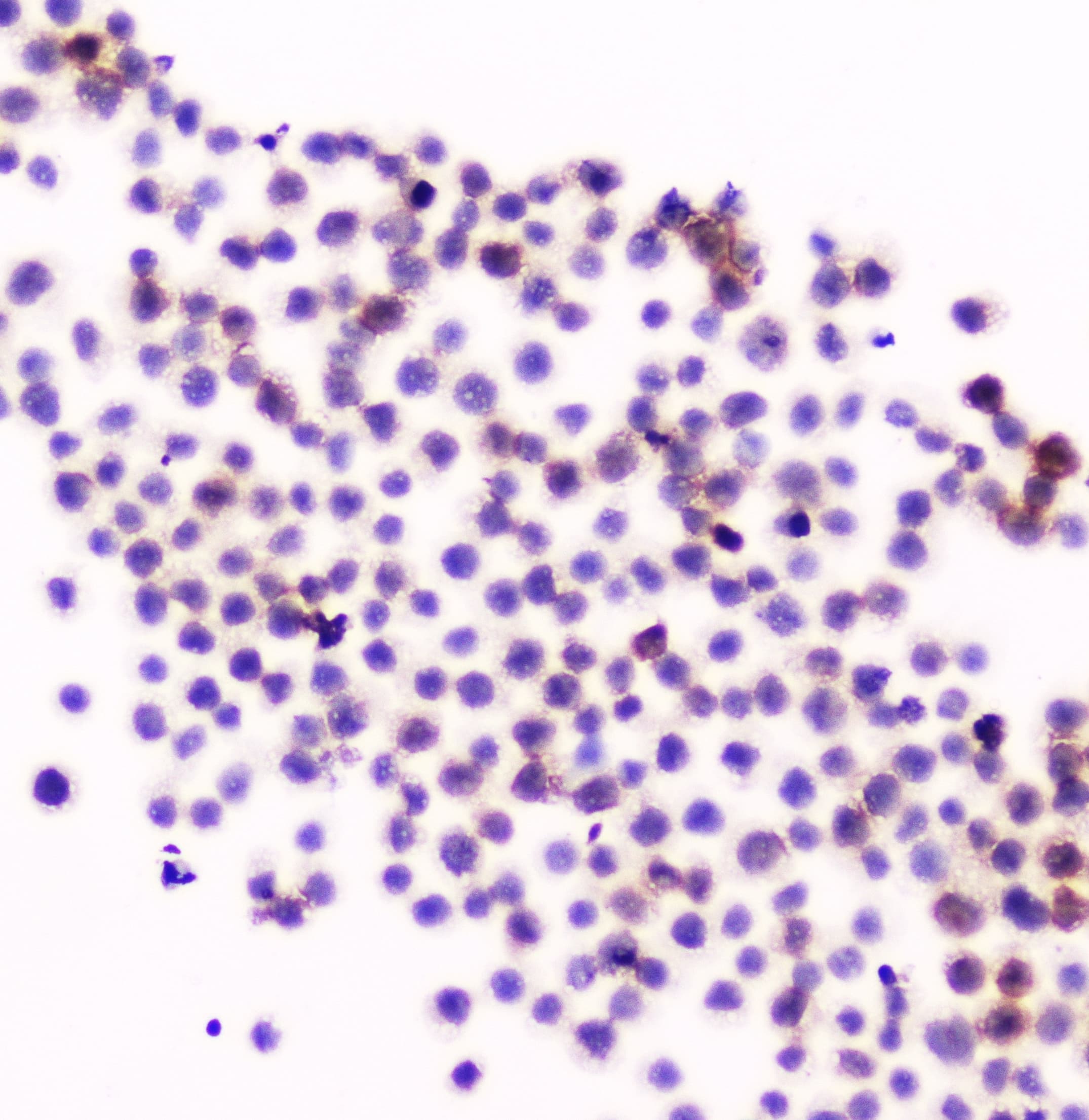 ITGAL / CD11a Antibody