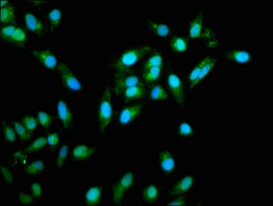 NAK / TBK1 Antibody