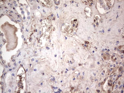 LGALS3 / Galectin 3 Antibody (clone OTI6E1)