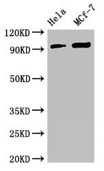 Polyclonal Rabbit anti-Human TTC27 Antibody (IHC, WB)