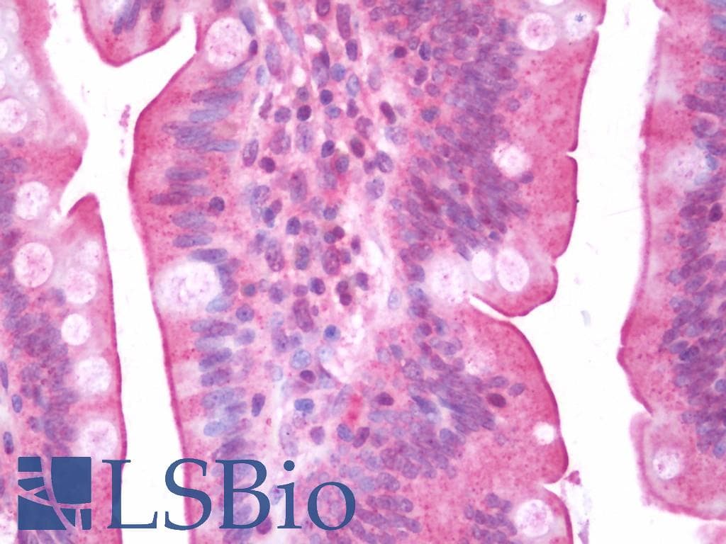 IHC-plus™ ENTPD3 Antibody (aa200-459)