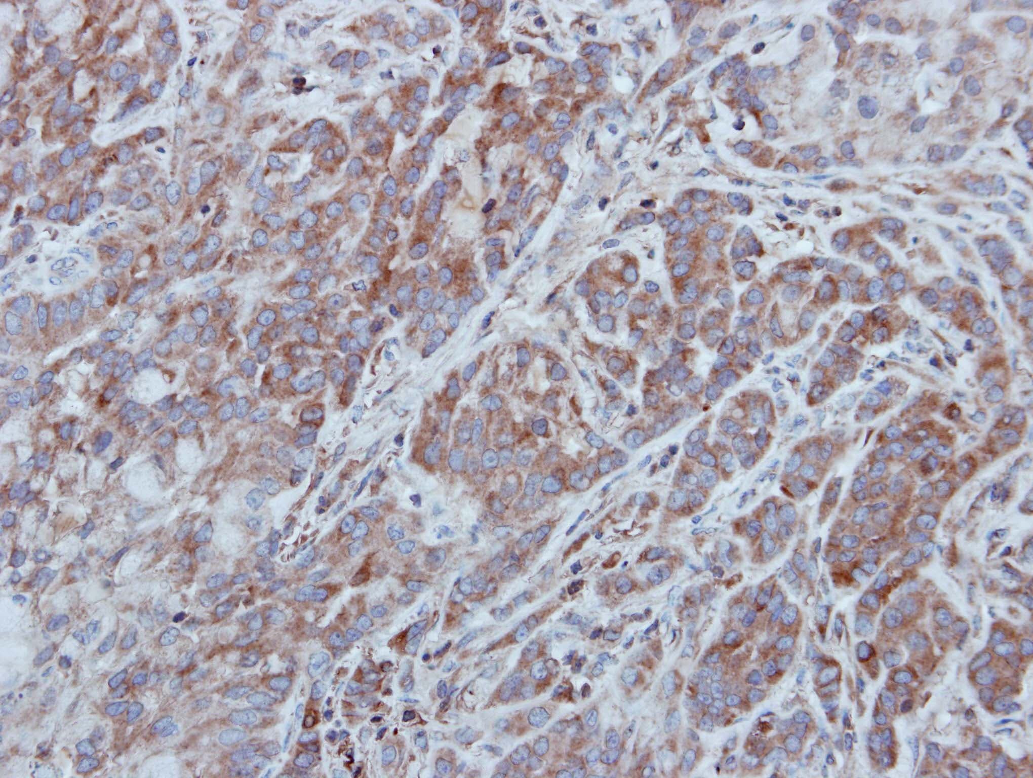 UNC13B Antibody (aa680-957)