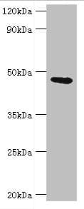 Polyclonal Rabbit anti-Human GATM / AGAT Antibody (aa124-423, IHC, WB)
