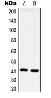 Polyclonal Rabbit anti-Human HTR4 / 5-HT4 Receptor Antibody (N-Terminus, WB)