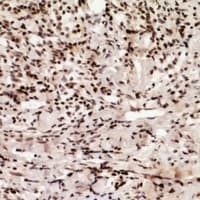 HIRIP3 Antibody