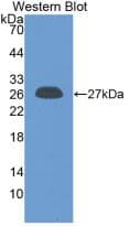 CRP / C-Reactive Protein Antibody (aa20-230, PE)