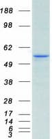 Human CA9 / Carbonic Anhydrase IX Protein (Recombinant Myc-DDK (Flag))