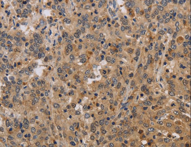 ELAVL2 / HUB Antibody