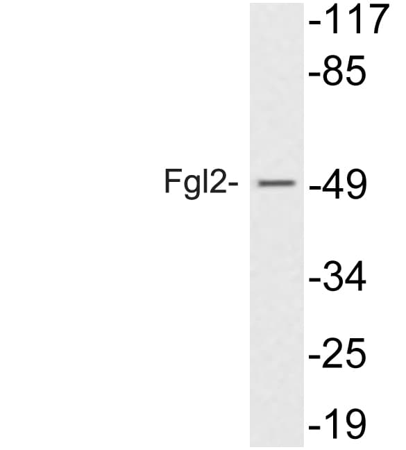 Polyclonal Rabbit anti-Human FGL2 Antibody (Val38, WB)