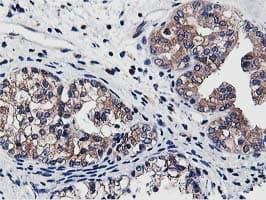 Monoclonal Mouse anti-Human ATG3 Antibody (clone OTI2C12, IHC, IF, WB)