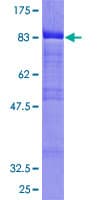 Human BLNK Protein (Recombinant GST)