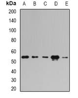 PDHX / Protein X / ProX Antibody
