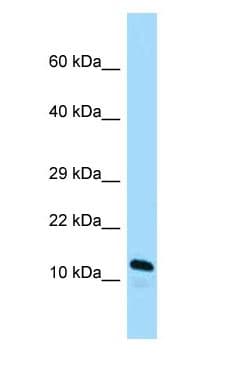 ARL2BP / BART Antibody (C-Terminus)