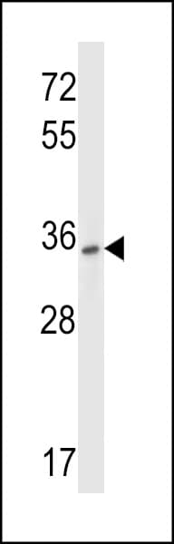 P2Y10 / P2RY10 Antibody (aa125-153)