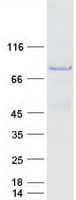 Human NUMB Protein (Recombinant Myc-DDK (Flag))